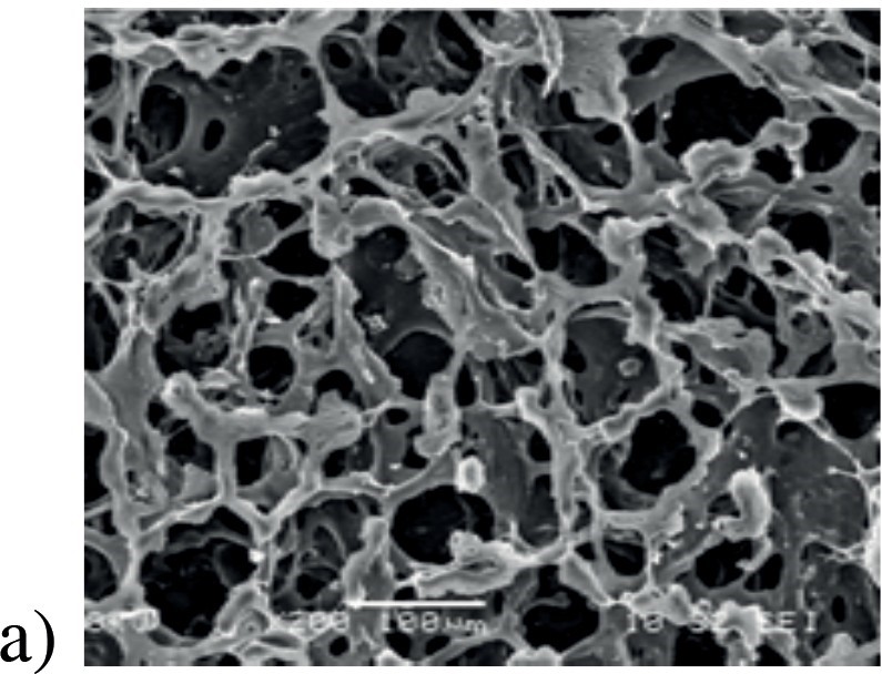 Developpement D Une Plateforme De Detection En Polymere Nanocomposite Pour Une Application Medicale Irdl